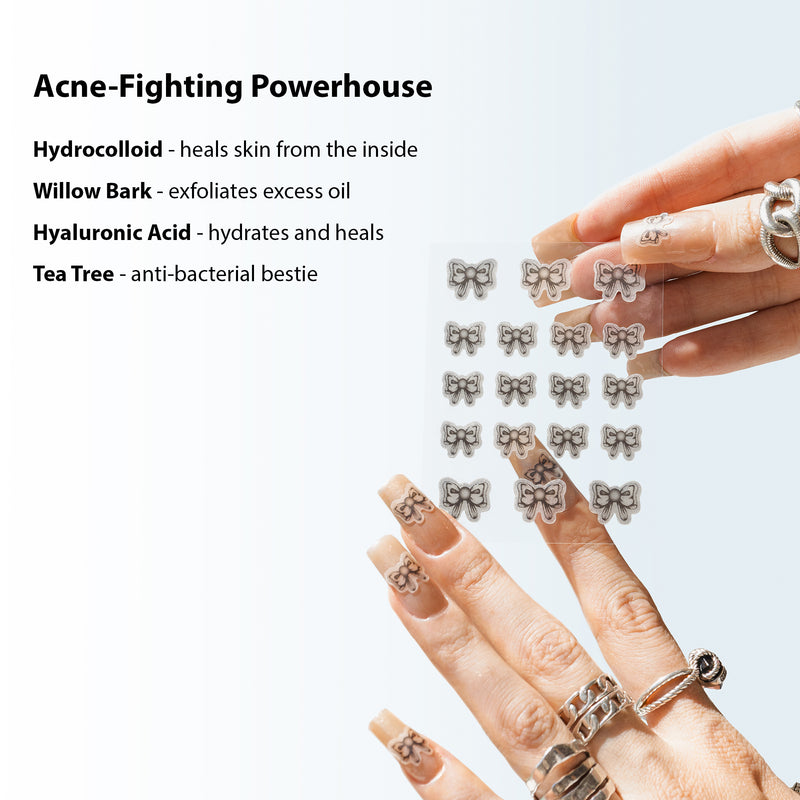 Knot Now Pimple Patches | 18 Black & White Bows